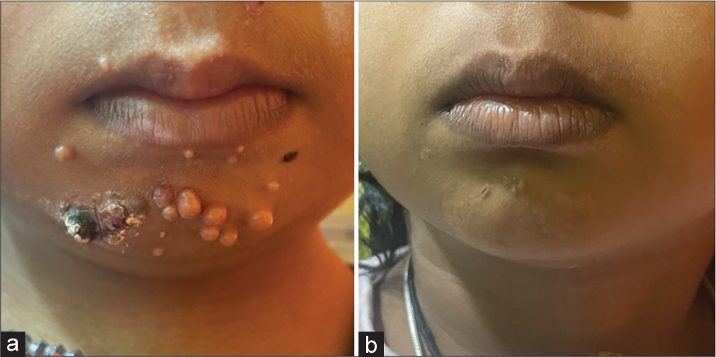 (a) Before treatment. (b) After treatment.