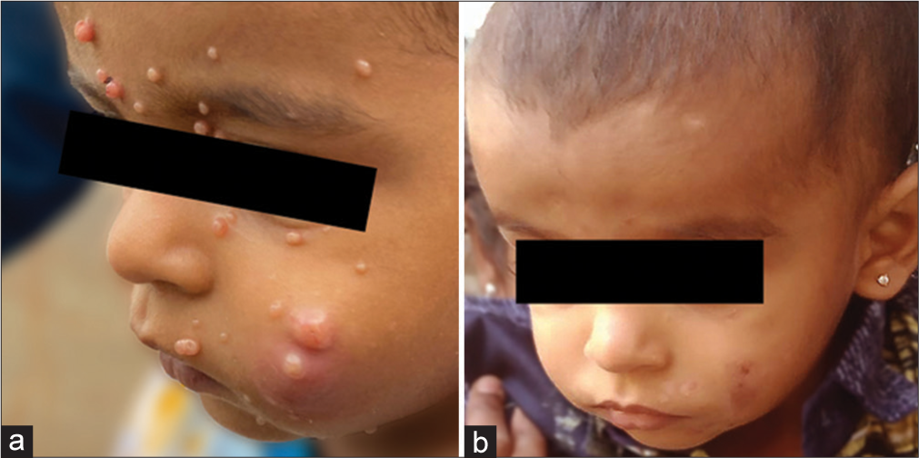 (a) Before treatment. (b) After treatment.